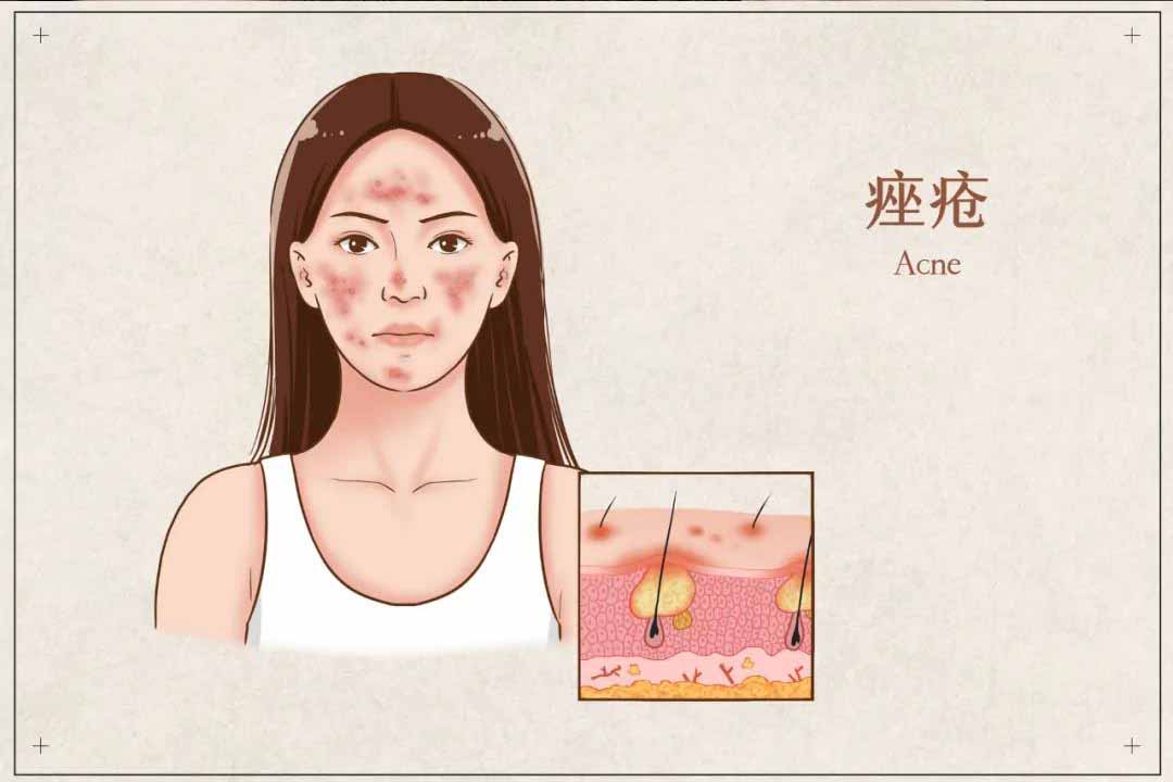 <b>荣成睿辰//一提到女性私密保养你就害羞，真的大</b>