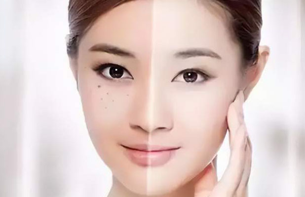 <b>睿辰科普  脸色暗沉是天生皮肤黑？</b>
