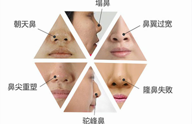 <b>睿辰科普  鼻部的美学标准有哪些。</b>