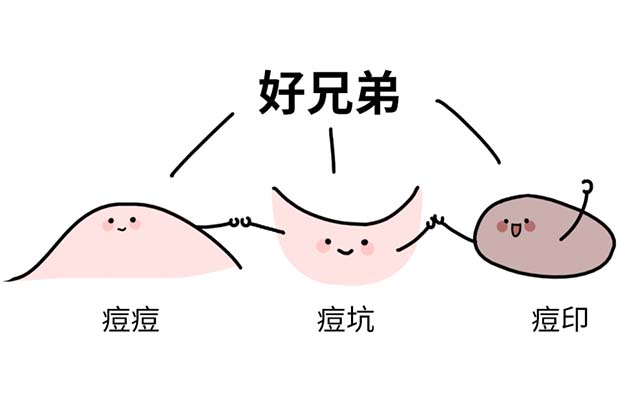 <b>荣成睿辰丨这3种祛痘的方式，真的会让痘痘越祛</b>
